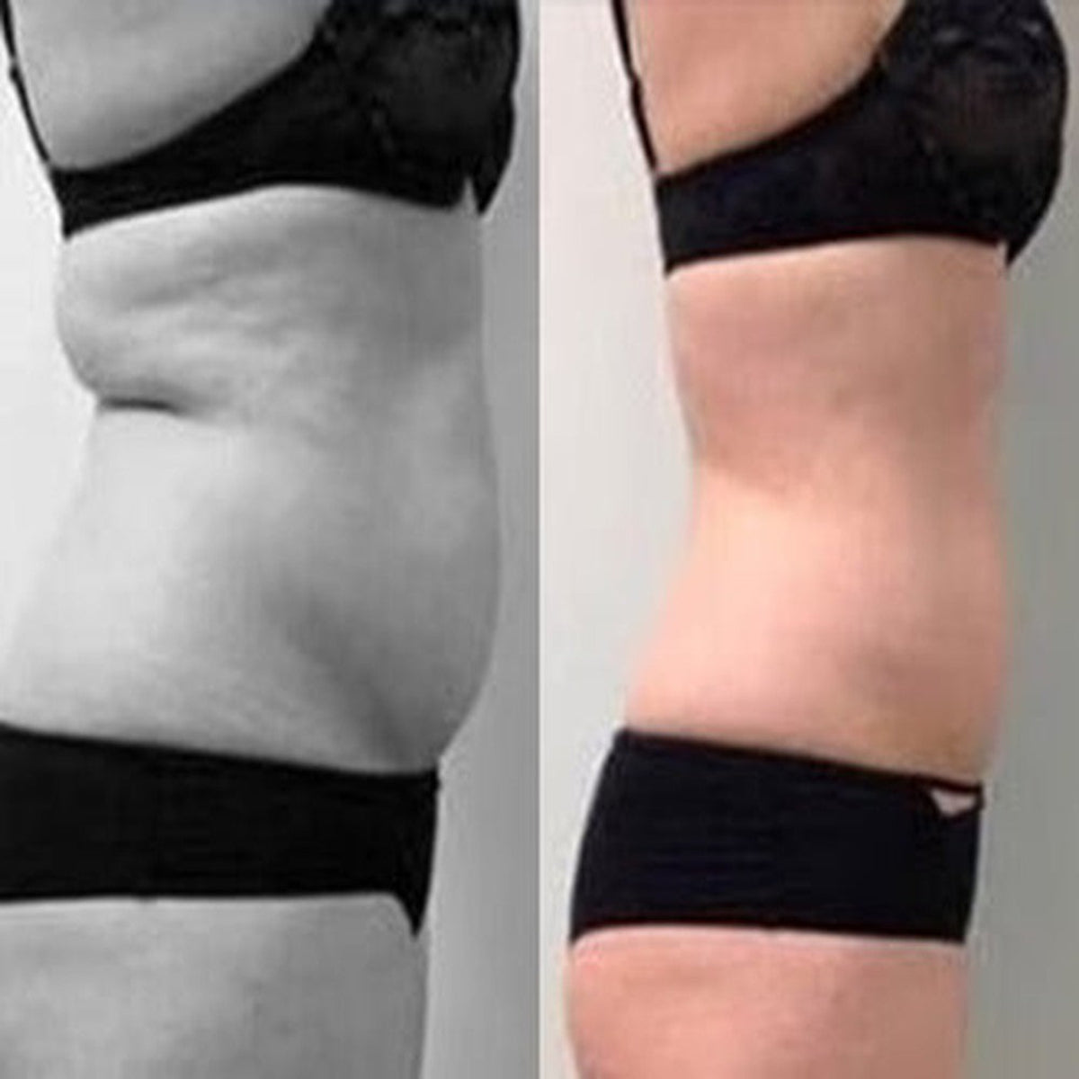 BellyLite Pro